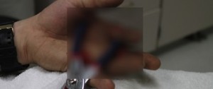 thumb